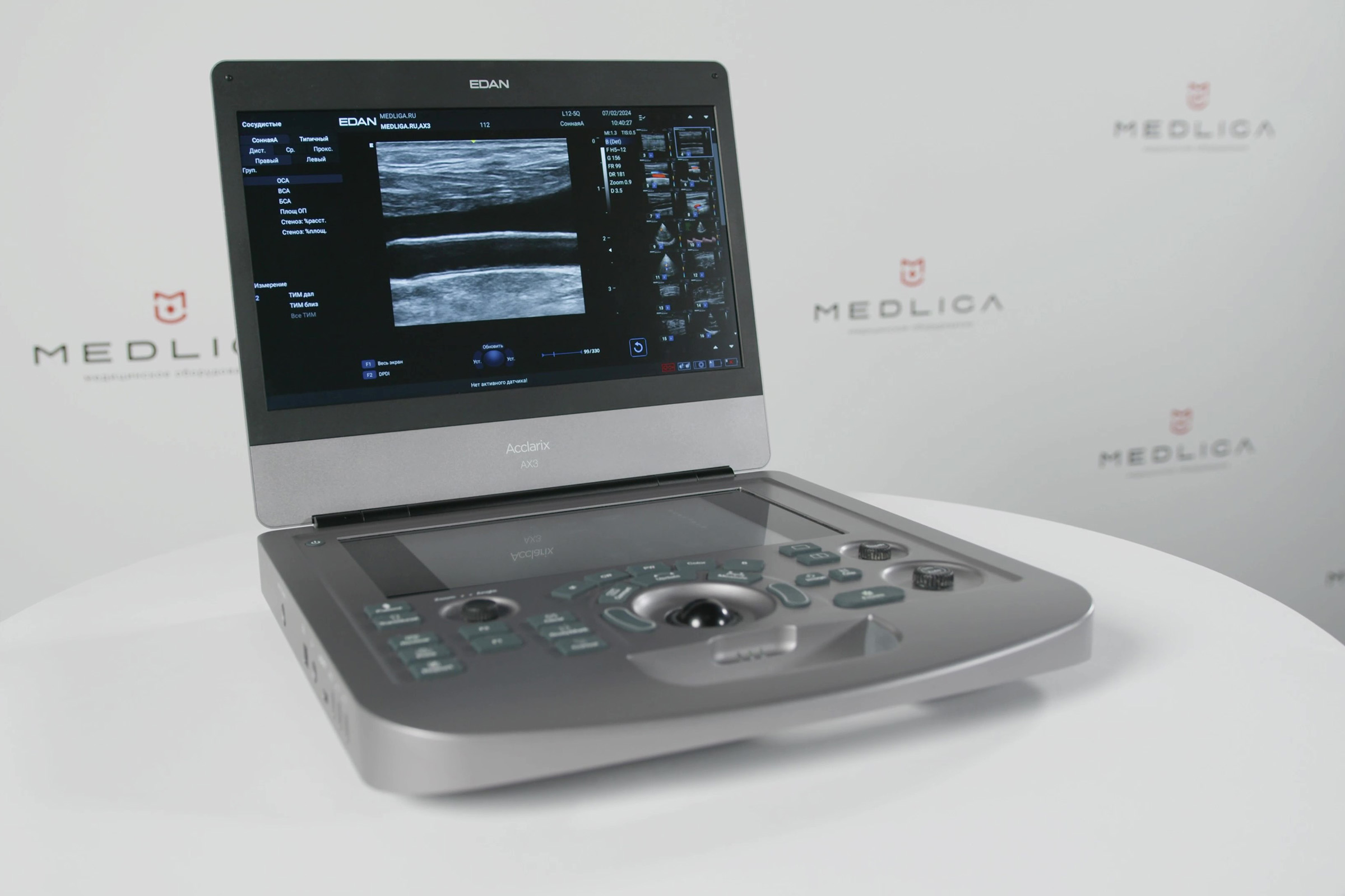 Видеообзор УЗ аппарата EDAN Acclarix AX3