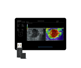 NTE (Natural Touch Elastography)