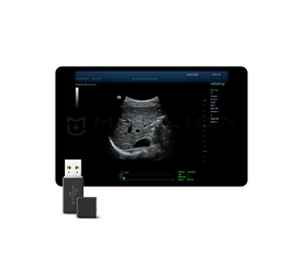 STQ (Sound Touch Quantification)