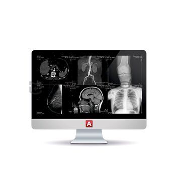 Серверы хранения данных для МРТ аппаратов MedRay