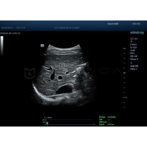 STQ (Sound Touch Quantification), 2