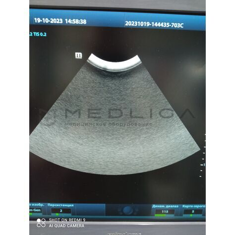 Mindray C5-2E (БУ, 2021), Серийный номер: VST18089926, 4