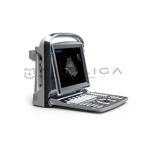 Chison SonoTouch 20, 2