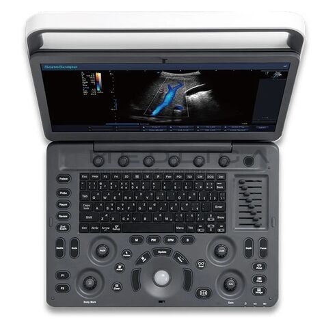 УЗИ аппарат SonoScape E2 Vet, 2